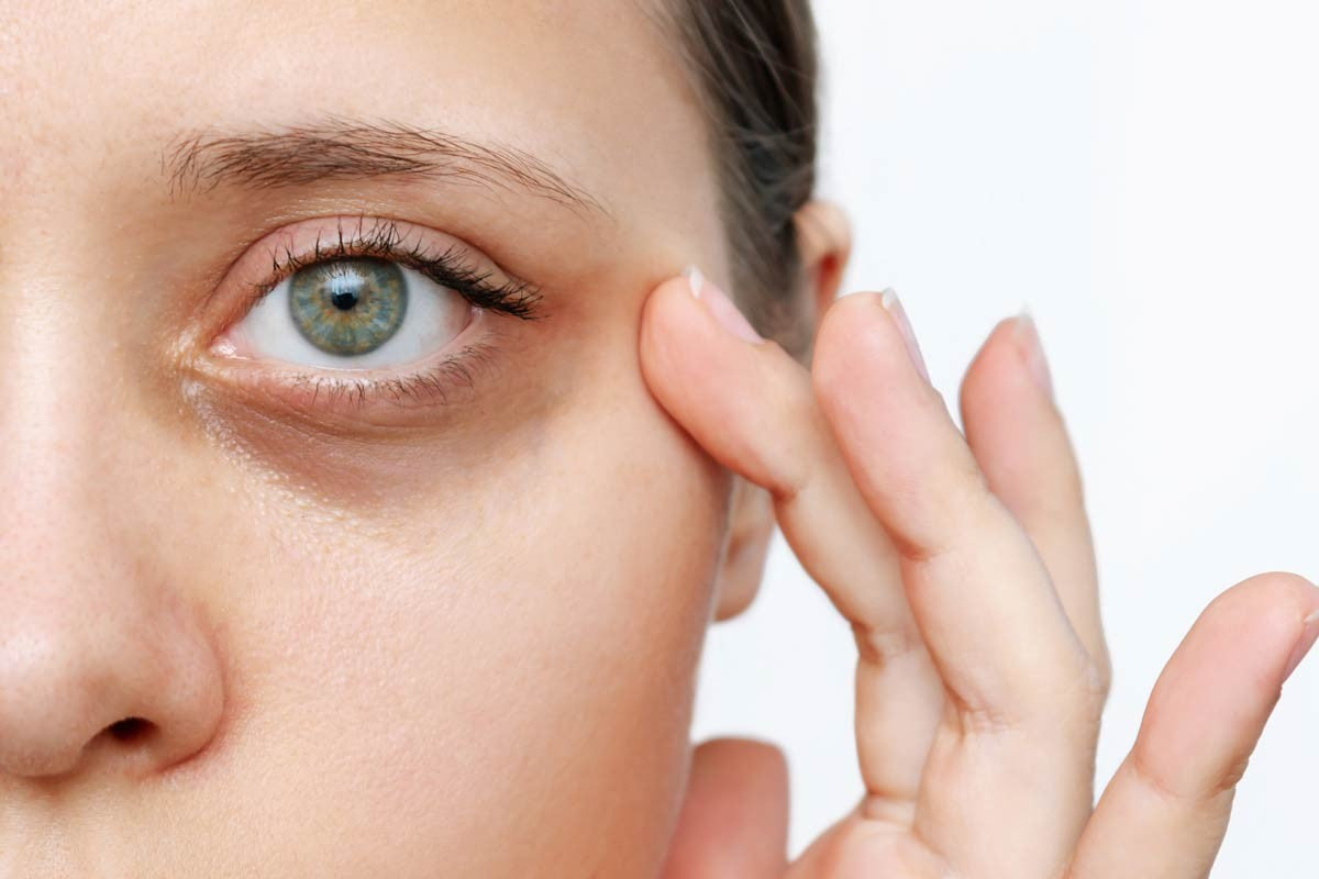 Cómo Minimizar las Ojeras y las Bolsas Debajo de los Ojos: Consejos y Recomendaciones